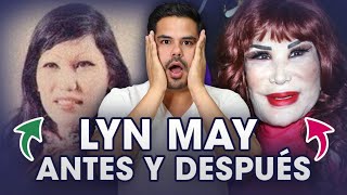 ¿QUÉ SUCEDIÓ con LYN MAY? la HISTORIA REAL | Cirugías Plásticas y Medicina Estética | Dr Saucillo