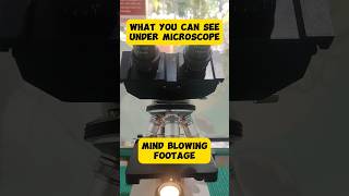 Mengerikan Begini Penampakan Scabies Dan Jamur Pada Hewan.