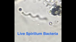 Spirillum Bacteria