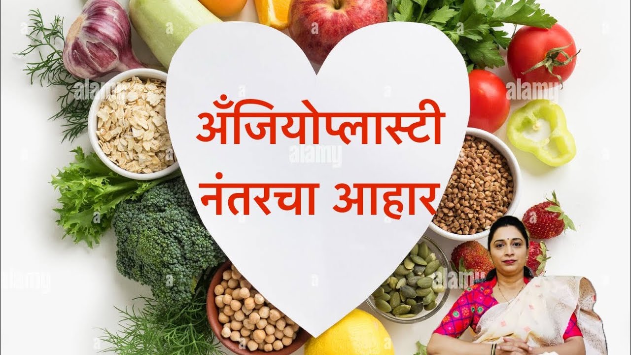  अँजियोप्लास्टी नंतरचा आहार कसा असावा?