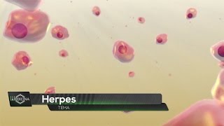 Medicina para todos: Herpes