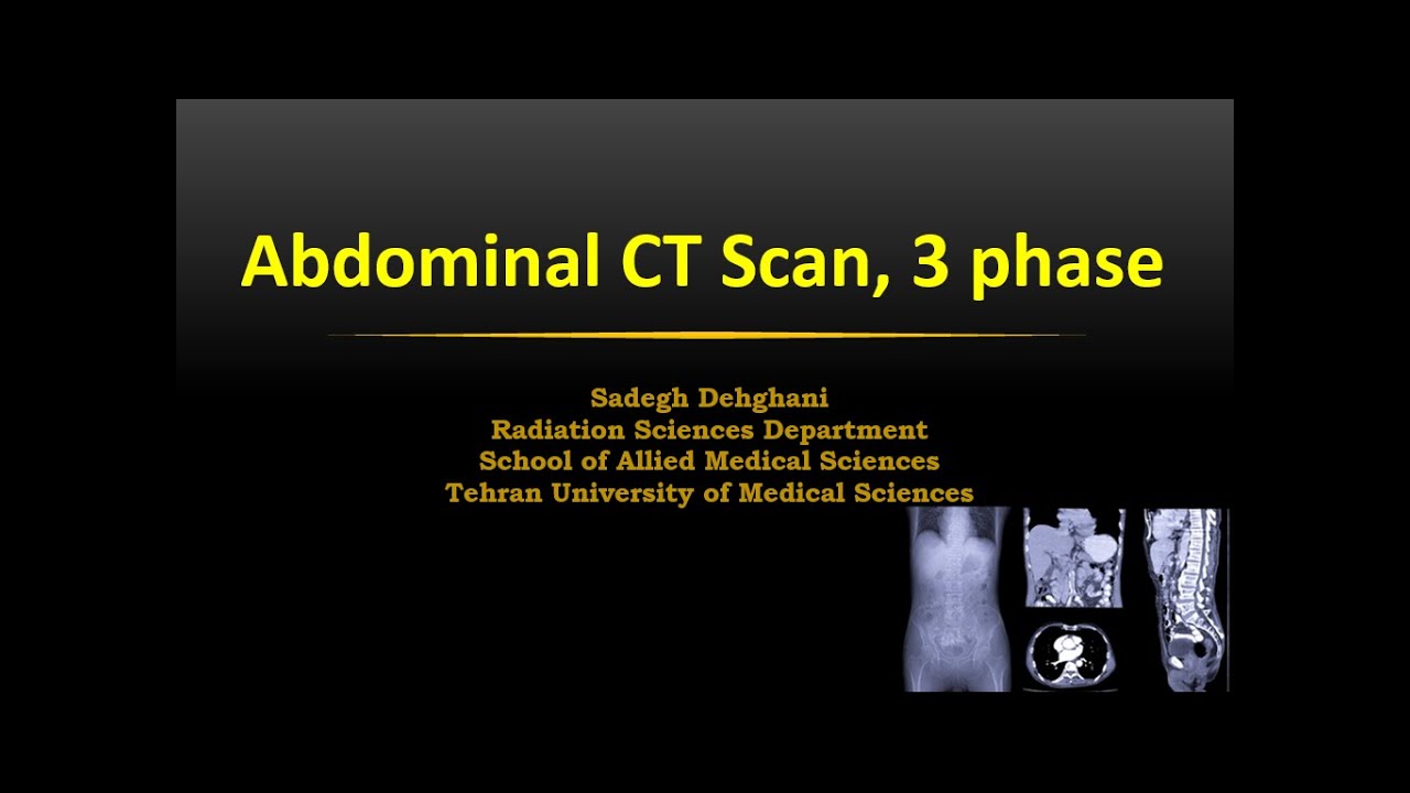 MedImag: Optimization of Techniques in CT of the Abdominal CT, 3 phase ...
