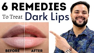 Dark Lips Treatment || DIY 6 Home Remedies screenshot 5
