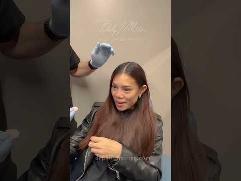Video thumbnail: Subtle But Effective Liquid Rhinoplasty Results! Non-Surgical Solution To Refresh Your Look!