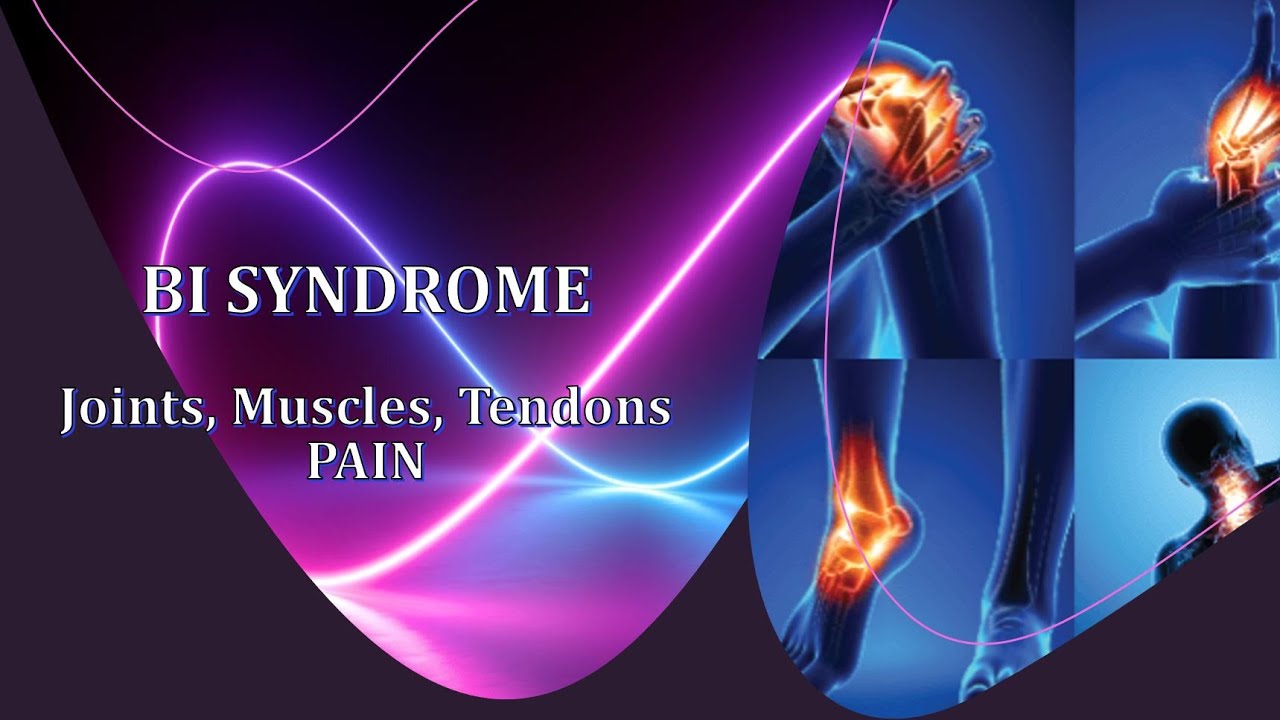 Bi Syndrome Joint, Muscle, Tendon Pain YouTube