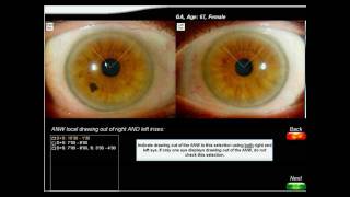 Iridology-Software Part 2.avi
