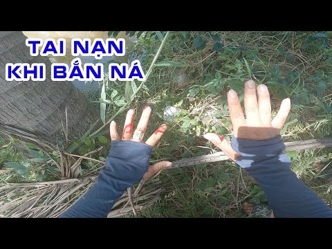 Video Tại Nạn Bắn Vào Tay Khi Bắn Ná Cao Su - youtube