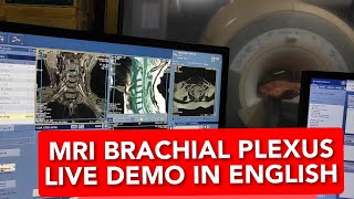 Brachial plexus MRI scan protocol, positioning and planning on GE 1.5 Tesla | Live Demo in English.