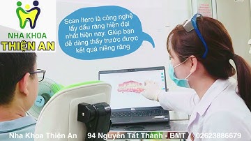 Scan Itero - công nghệ lấy dấu răng hiện đại nhất - thấy trước được kết quả niềng răng!