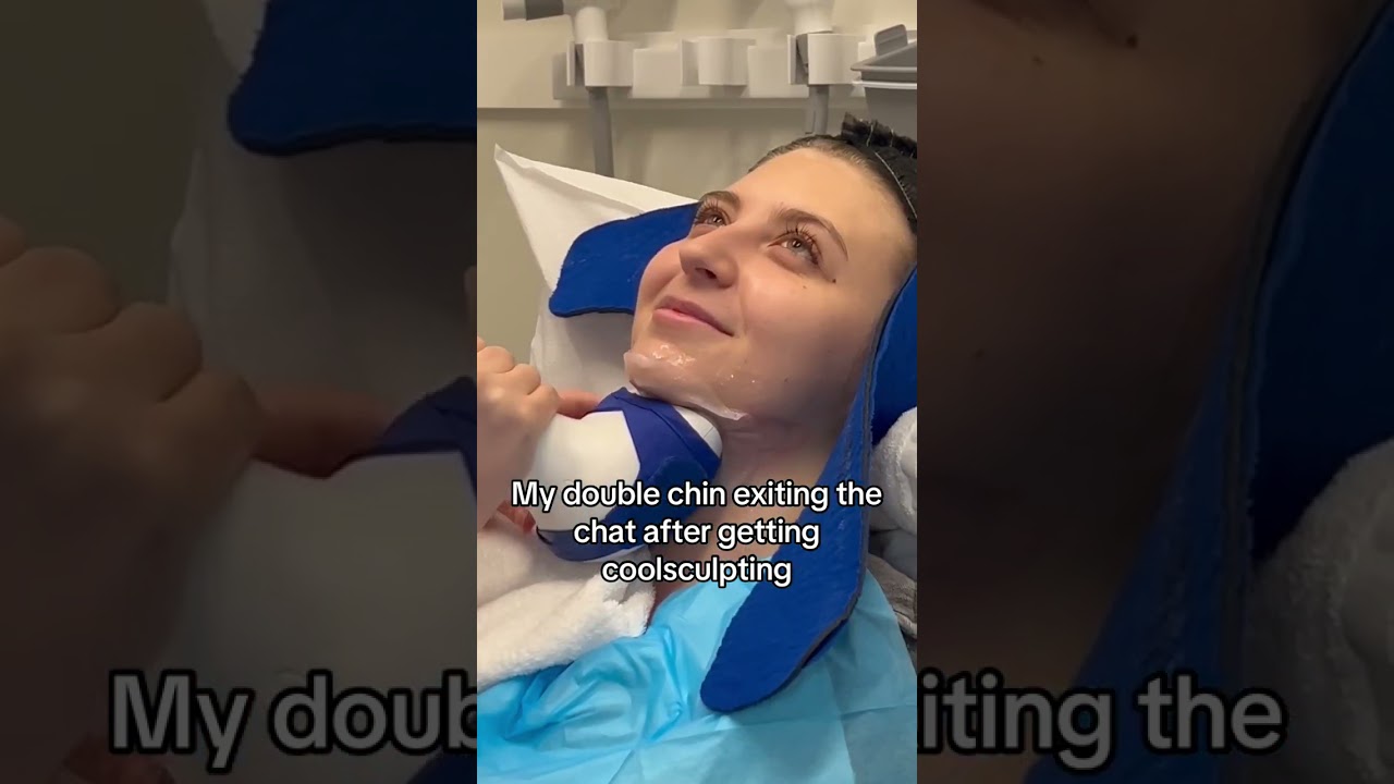 DOUBLE CHIN? NOT ANYMORE 