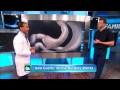 Doctors TV Weight Loss, Sleeve Gastrectomy by Dr. Feiz - Part 3