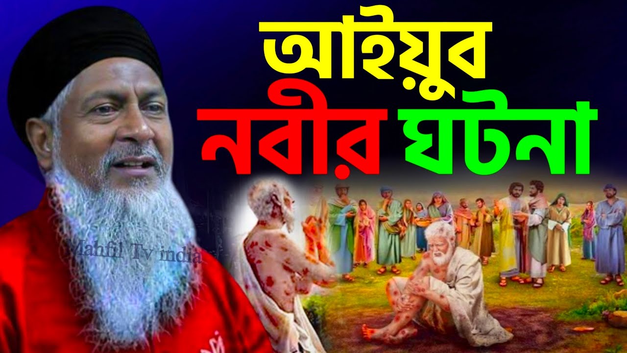 আইয়ুব নবীর কুষ্ঠ রোগের ঘটনা┇Maulana Joynal Abedin Saheb┇জয়নাল আবেদীন ওয়াজ┇bangla waz┇#waz┇#bayan