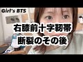 右膝前十字靭帯の手術について・退院しました！【vlog】【リハビリ】｜Girl's BTS    次の動画リクエストあればコメントへ！