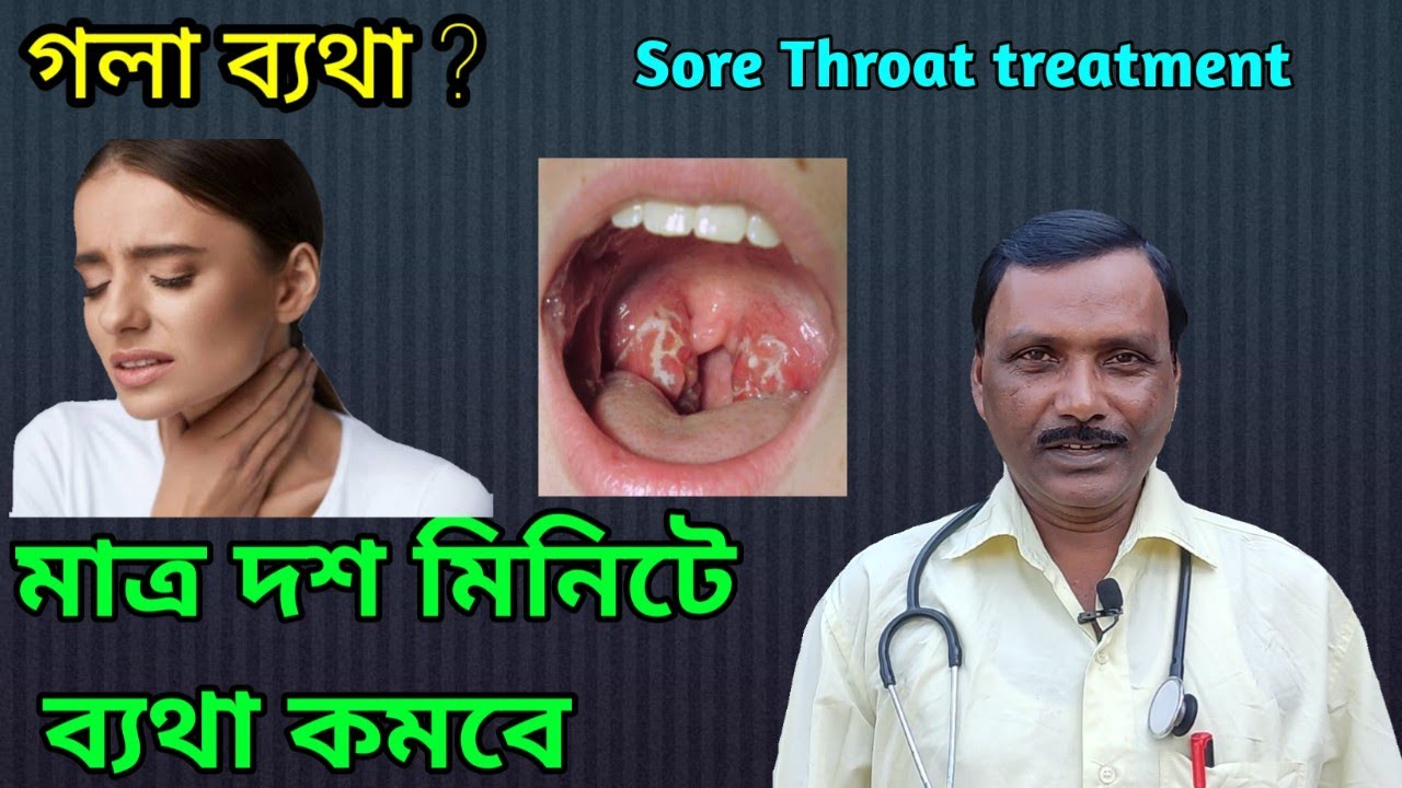 dharmanagar homoeopathic doctor || গলা ব্যথার হোমিওপ্যাথিক ঔষধ || Dr SP Goswami