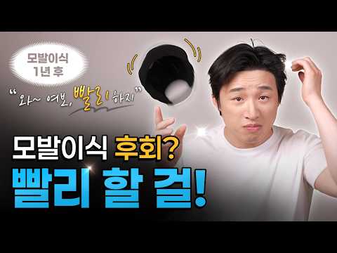"빨리 할 걸...후회는 딱 그거 하나예요" 남자 M자 모발이식 1년 경과 | 모제림성형외과