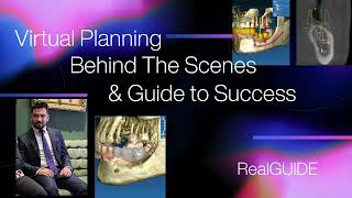 RealGuide extraction tooth or cut STL file
