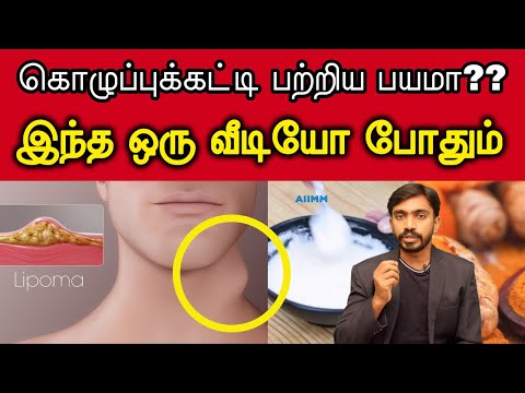 கொழுப்பு கட்டி எவ்வளவு ஆபத்தானது? அதை சரிசெய்ய, வராமல் தவிர்க்க என்ன செய்ய வேண்டும்? | LIPOMA |DrSJ