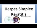 Ophthalmology 116 Herpes Simplex Keratitis Virus Cornea Dendritic HSV Wessley NeuroTrophic Disciform