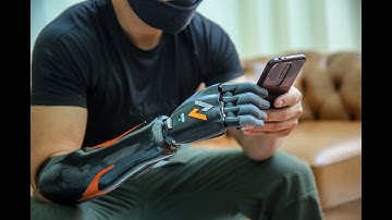 Cánh tay robot Made in Vietnam cho người khuyết tật