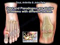 Gout , Pseudogout  & Joint Pain - Everything You Need To Know - Dr. Nabil Ebraheim
