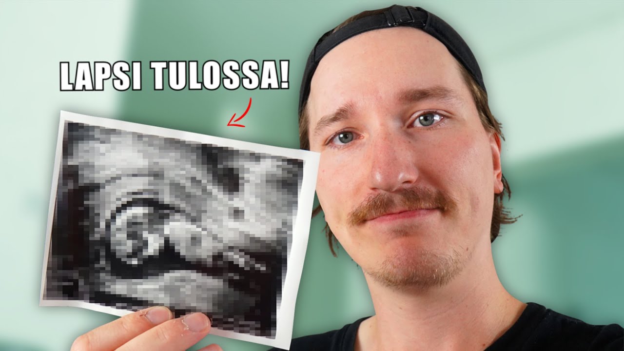 Harrille toinen LAPSI!?