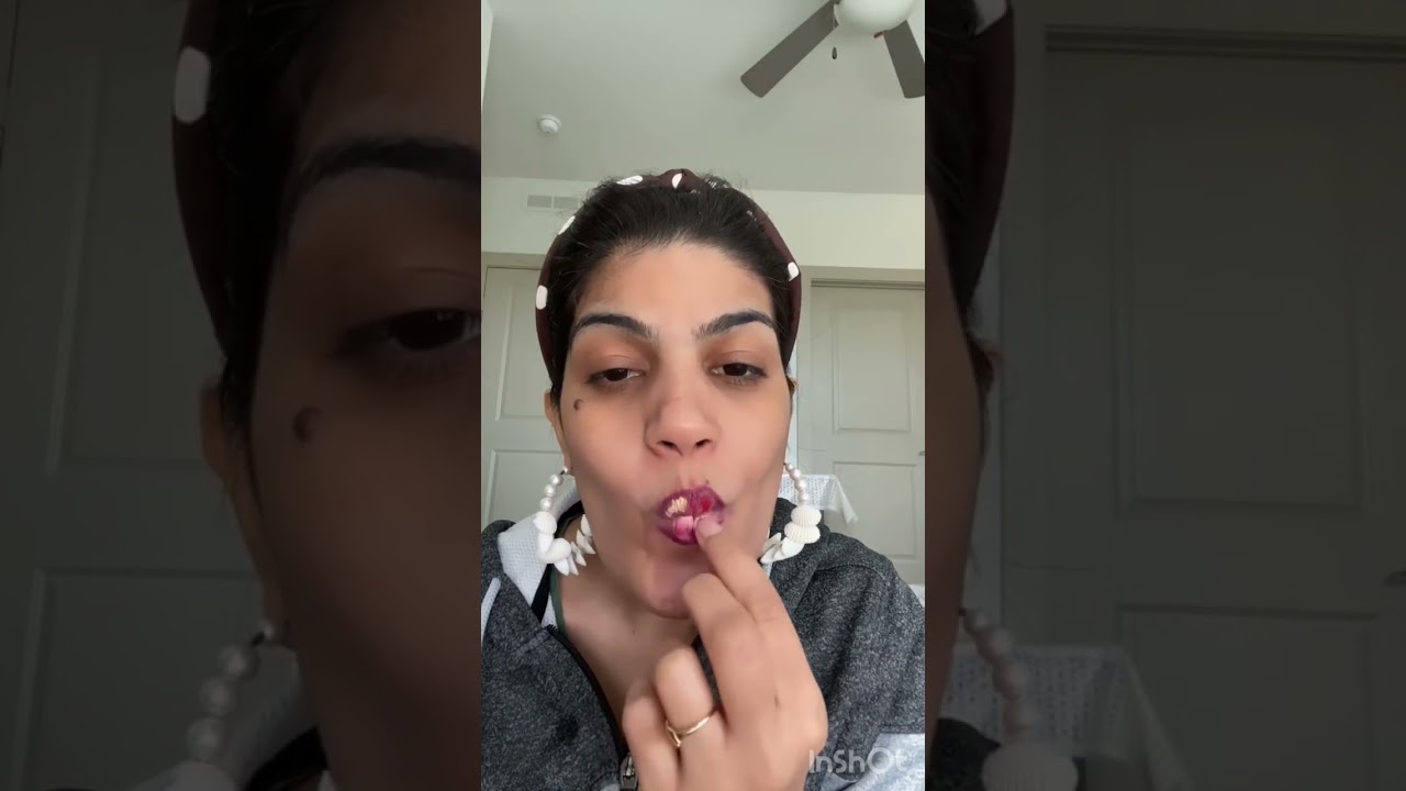 lip filler technique 