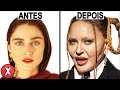 11 FAMOSOS QUE FIZERAM HARMONIZAÇÃO FACIAL / MAS ERAM MAIS BONITOS ANTES