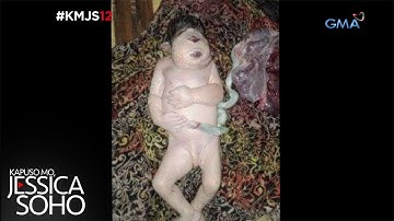 Kapuso Mo, Jessica Soho: Ang Cyclops Baby ng Sultan Kudarat