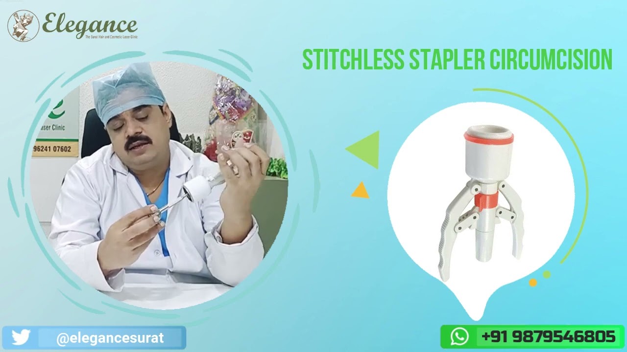 Stitchless Stapler Circumcision, ZSR Circumcision, Painless, Advanced Stapler, Surat, Anand, Gujarat