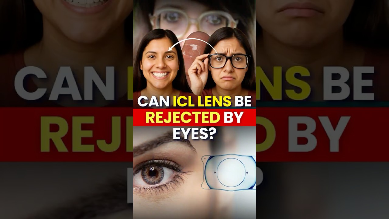 Can Your Body Reject ICL Lens? 🤔 Truth You Should Know 👁️✨