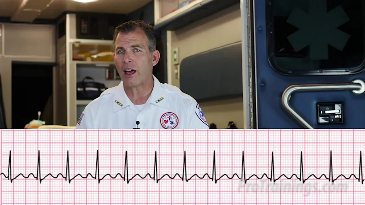 Supraventricular Tachycardia (ECG Rhythm Interpretation)