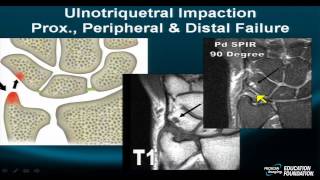 Mri Online Wrist, Part Vii