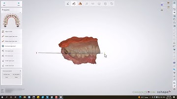 CUD Reference Denture Design