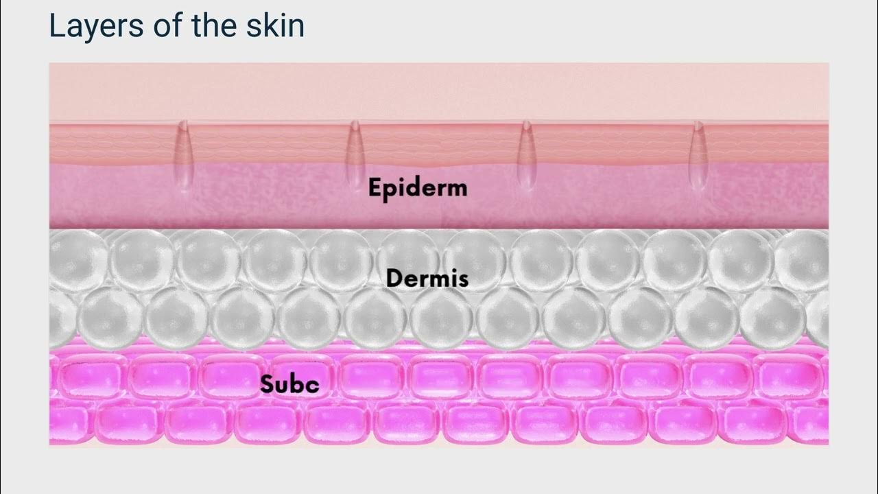 LASER TISSUE EFFECTS AND PHOTONS YouTube