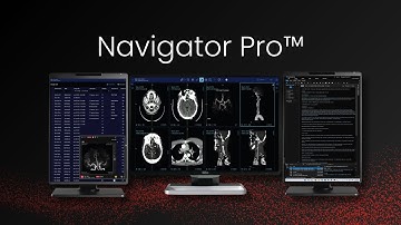 RapidAI | Rapid Navigator Pro™| Deep clinical AI for triage, workflow, and reporting in radiology