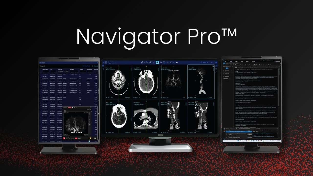 RapidAI | Rapid Navigator Pro™| Deep clinical AI for triage, workflow, and reporting in radiology