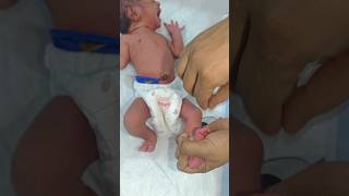 Baby RBS Test 😱#shorts #newborn #youtubeshorts #cutebaby #glucose #premature #doctor #medicalstudent