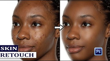 Skin Retouch in Photoshop / Remove Pimples/ step by step