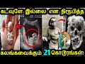 கண்ணீர்வரவைக்கும் 21 மனிதர்கள்! | Real People With Extremely Weird Diseases | Tamil Ultimate