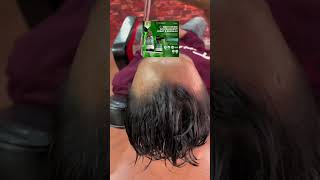 MOICARE 2 PCS PAKET Hair Serum