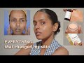 My skincare journey everything i did for even skin tone