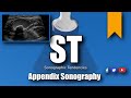 Appendix ultrasound