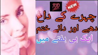 Chehry k dano ka ilaj | face pimples treatment in urdu. #WATips