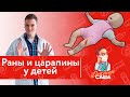 Глубокие Раны и Царапины у детей | Неотложная помощь | Доктор Саша