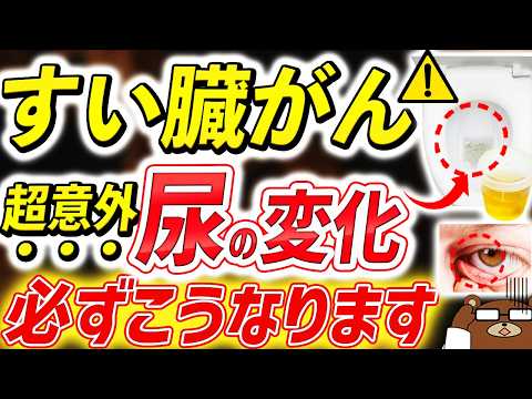 放置厳禁！「尿」と「便」に出るSOSサインを絶対に見逃さないで。超意外なすい臓がんの初期症状とは。救命率の最も低いすい臓がんを早期発見、予防するためにできる事は？医師が徹底解説。