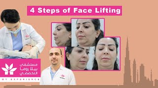 4 Steps Face Lifting | Bella Roma Specialty Hospital LLC