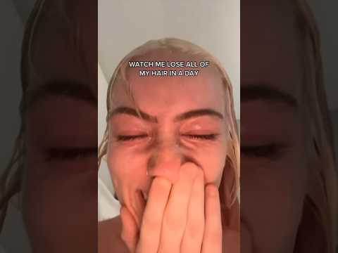 The Original Video Of My Hair Falling Out Hairfail Gonewrong Hair Bleaching