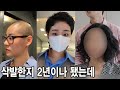 삭발하고 새로 기르면 금방 기를 줄 알았죠