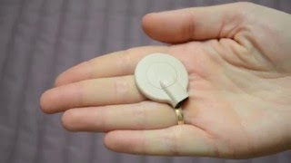 Как заменить магнит в катушке для речевого процессора Как заменить магнит в катушке для речевого процессора