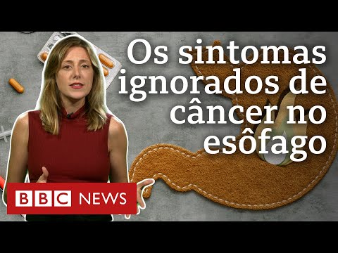 Vídeo: Câncer de esôfago